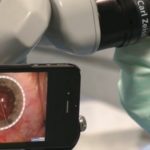 microsurgery