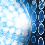 images from a computerized tomography of the brain and surgical lamps in operation room