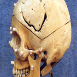 skull