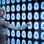 robot analyze x-ray brain