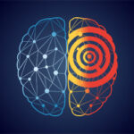 stereotactic