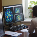 A radiologist is working on a CT scan of a brain tumor